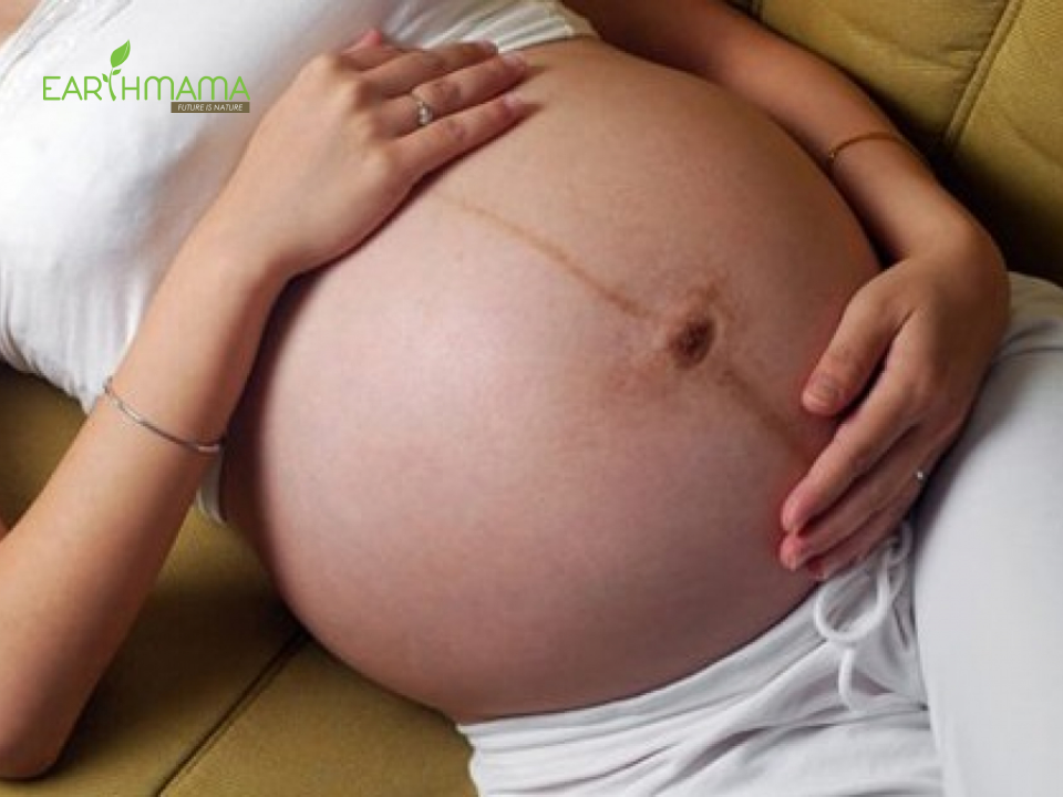 Sạm da là vấn đề mẹ thường gặp khi mang bầu