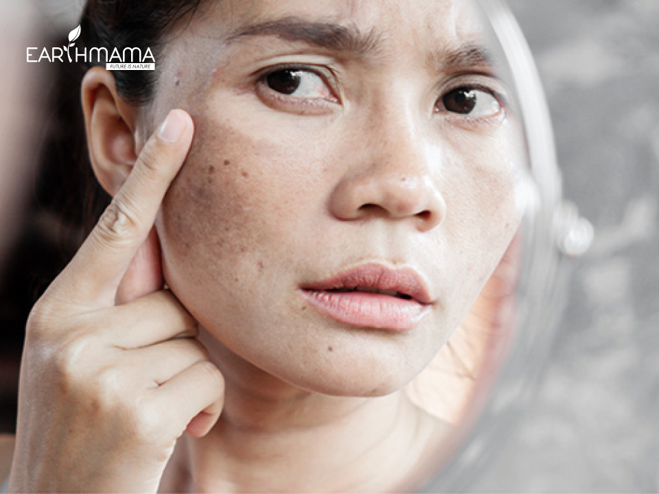 Sau sinh da mẹ thường sần sùi, xuống cấp