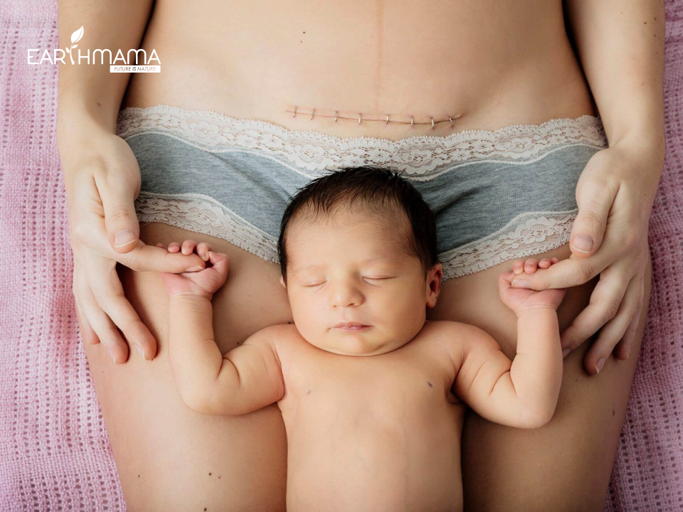 mẹ sau sinh mổ bao lâu thì ăn được thịt gà