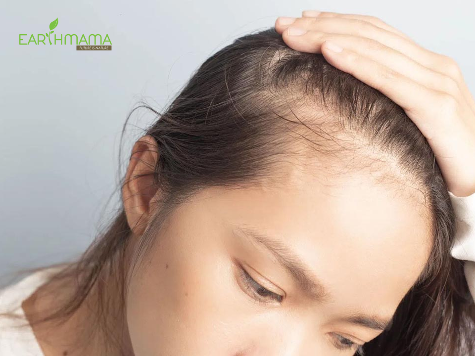 Dầu gội đầu chống rụng tóc và tránh bị hói