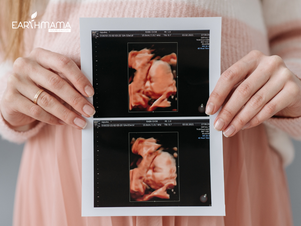 Tam cá nguyệt thứ 3 kéo dài từ tuần 28 đến tuần 40